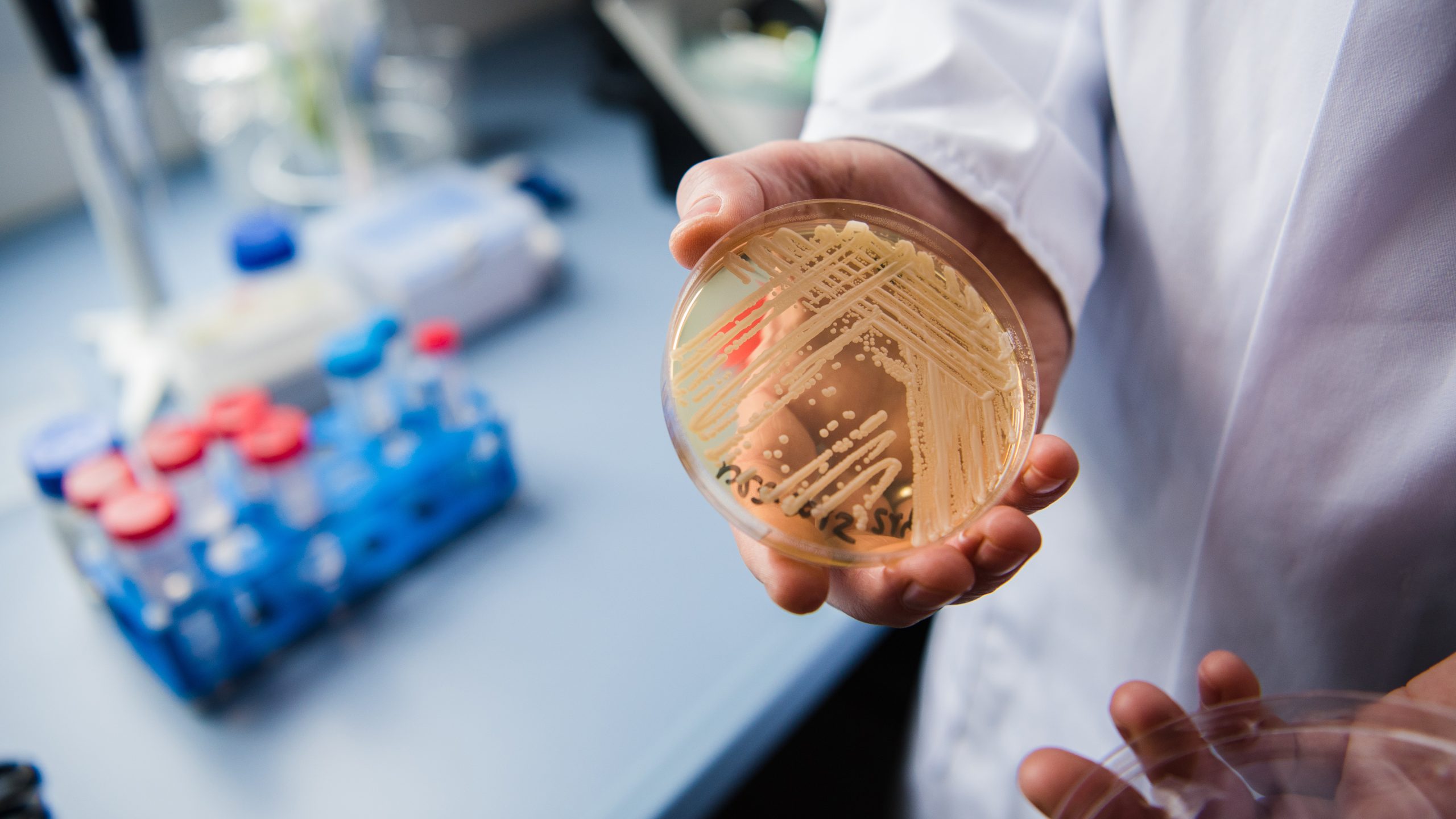 New study reveals why dangerous fungus is so difficult to treat — KTVU FOX 2 Bay Area, Mill Valley Community news